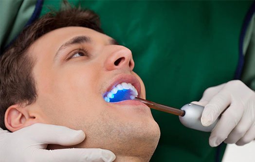 dental-abscess-leichhardt