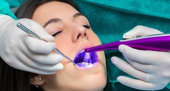 fissure-sealants-leichhardt