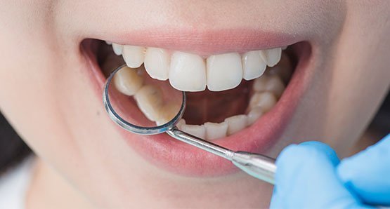 full-mouth-rehabilitation-leichhardt