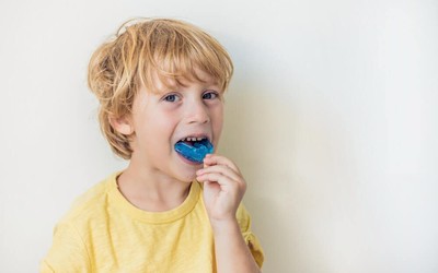 How to Choose a Comfortable Sports Mouthguard for Your Child