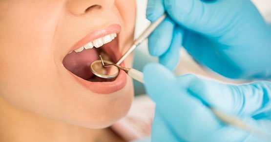 lost dental restorations leichhardt