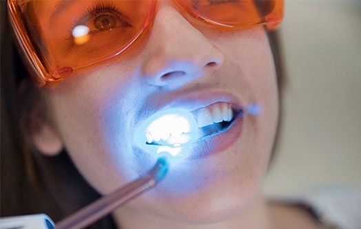 symptoms-of-dental-abscess-leichhardt