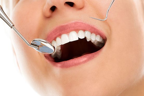 tooth wear leichhardt