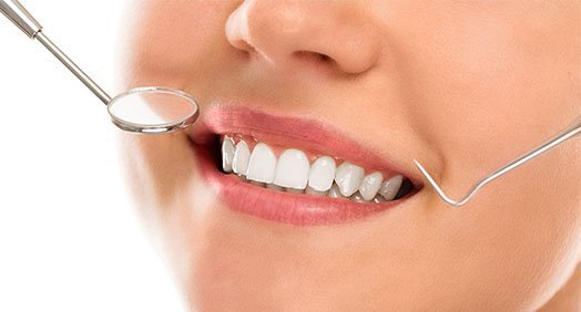 benefits-of-dental-bonding-leichhardt